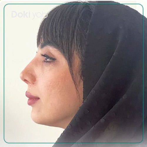 نمونه کار عمل بینی دکتر مجید راستی در اصفهان