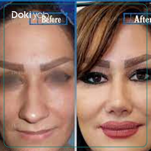 نمونه کار دکتر حبیب سهرابی