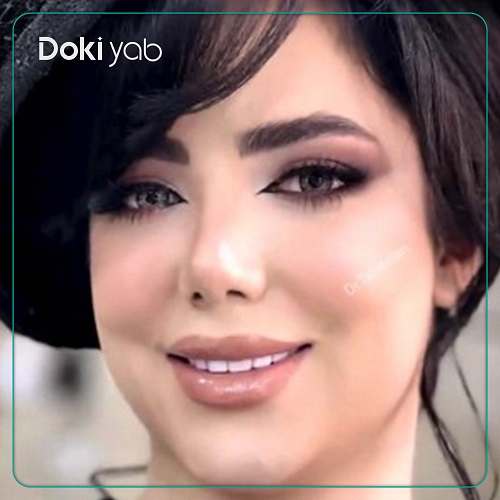 جراحی بینی توسط دکتر محمدحسین طاهریان