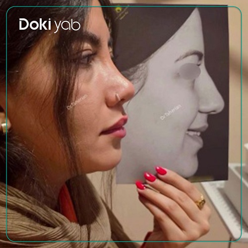 نمونه کار عمل بینی دکتر محمدحسین طاهریان در تهران