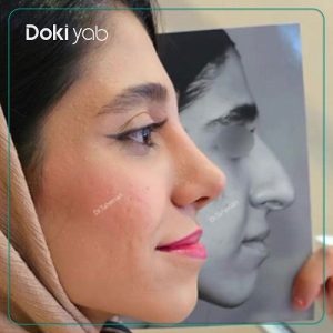 نمونه کار عمل بینی دکتر محمدحسین طاهریان در تهران