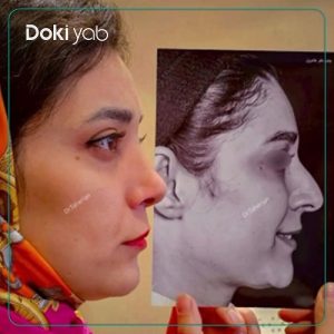 نمونه عمل بینی دکتر محمدحسین طاهریان در تهران