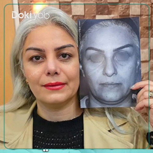 نمونه عمل بینی دکتر محمدحسین طاهریان جراح بینی تهران