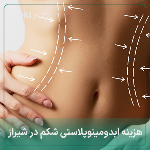 هزینه ابدومینوپلاستی شکم در شیراز 