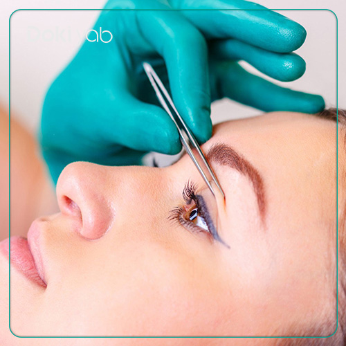 مراقبتهای بعد از عمل بلفاروپلاستی در شیراز