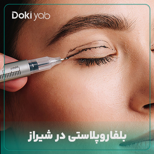 بلفاروپلاستی در شیراز؛ معرفی 12 پزشک ماهر + هزینه