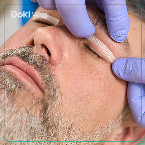 بررسی ماندگاری نتیجه بلفاروپلاستی