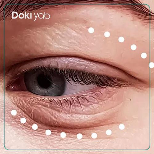 معرفی بهترین دکتر بلفاروپلاستی در شیراز در دکی یاب