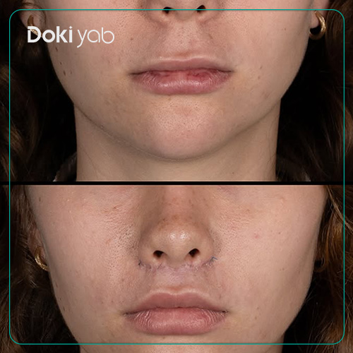 عکس سانترال لب؛ مجموعه دکی یاب