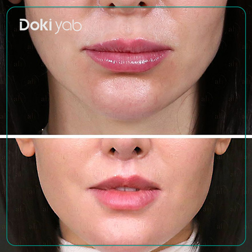 سانترال لب در شیراز در مجموعه دکی یاب