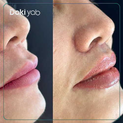 معرفی بهترین دکتر جراحی سانترال لب در شیراز در دکی یاب