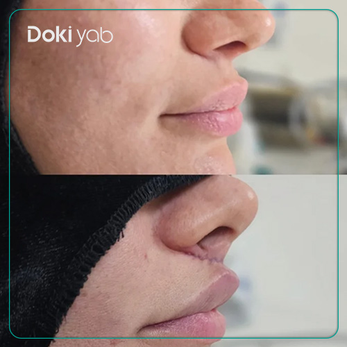 بررسی هزینه سانترال لب در شیراز در دکی یاب