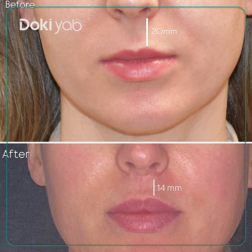 مراقبت‌های قبل از جراحی سانترال لب