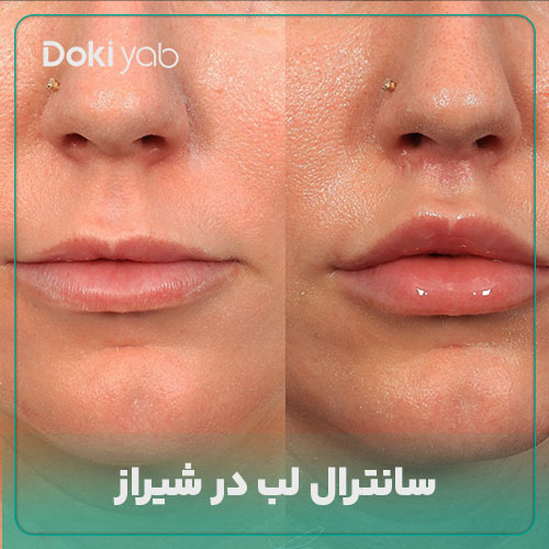 سانترال لب در شیراز؛ معرفی 11 دکتر ماهر + هزینه