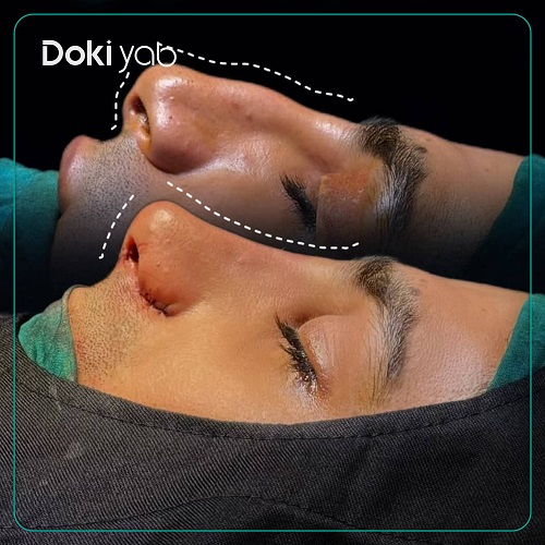 نمونه کار دکتر فرهاد محرابی سی سخت