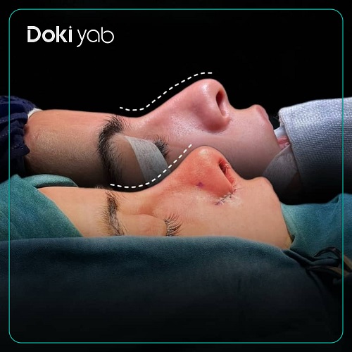 نمونه کار دکتر فرهاد محرابی در شیراز