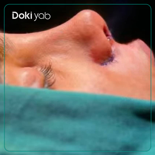 نمونه کار دکتر فرهاد محرابی جراح بینی شیراز