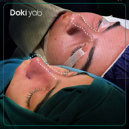 جراحی بینی دکتر فرهاد محرابی یاسوج