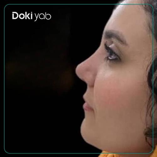 نمونه جراحی بینی دکتر فرهاد محرابی در شیراز