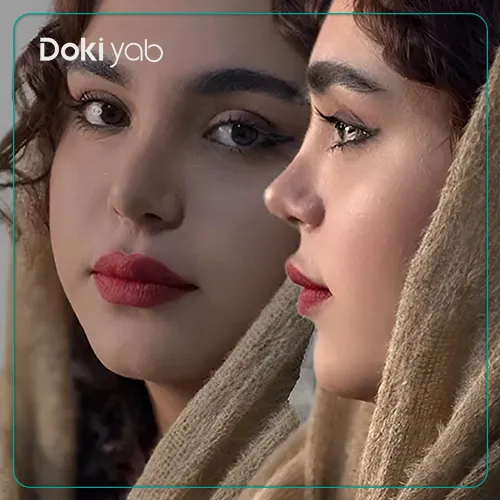 نمونه جراحی بینی با دکتر فرهاد محرابی در شیراز