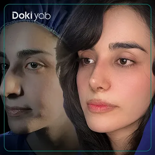 عکس نمونه کار جراحی بینی با دکتر فرهاد محرابی در شیراز