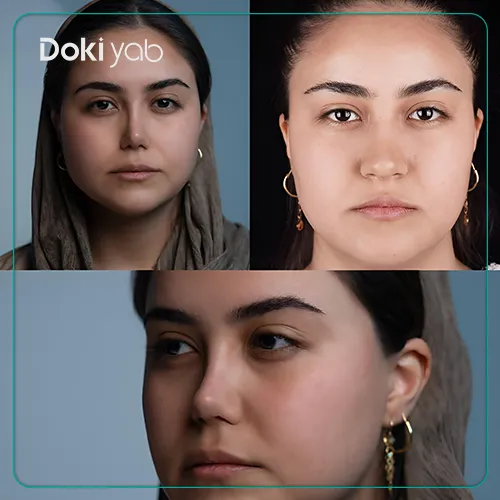 جراحی بینی توسط دکتر فرهاد محرابی در شیراز