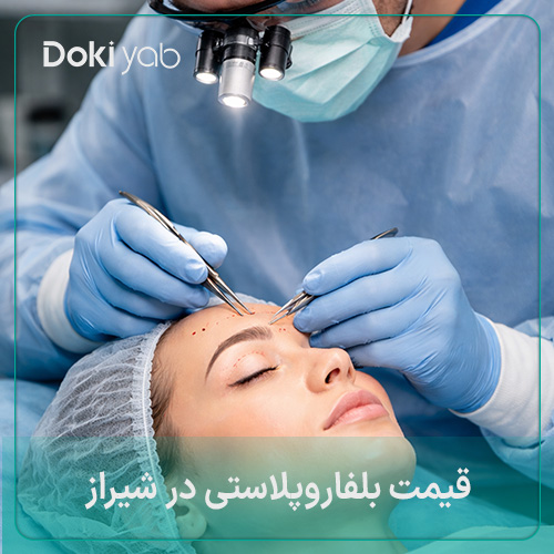 بررسی دقیق قیمت بلفاروپلاستی در شیراز