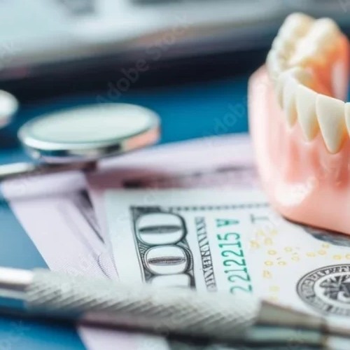 لمینت اقساطی دکی یاب