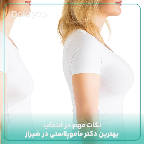 نکته‌های مهم برای انتخاب بهترین دکتر ماموپلاستی در شیراز