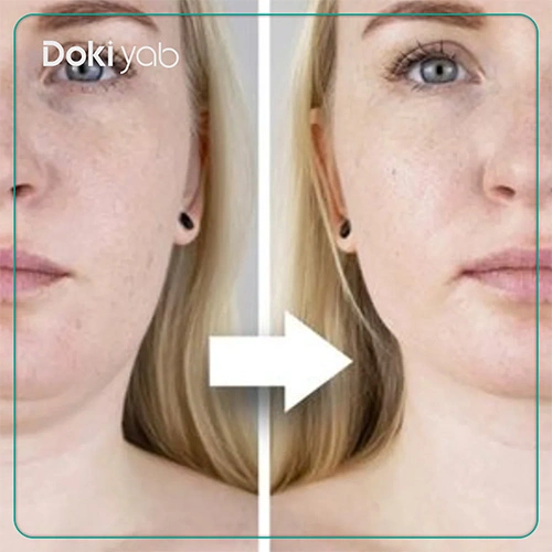 عمل رفع غبغب در شیراز 