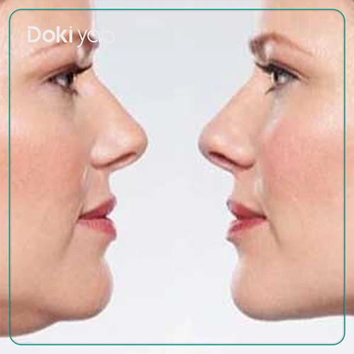 بهترین جراحان ساکشن غبغب در شیراز 