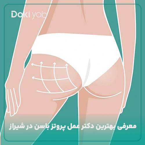 معرفی بهترین دکتر عمل پروتز باسن در شیراز با بررسی تخصصی دکی یاب