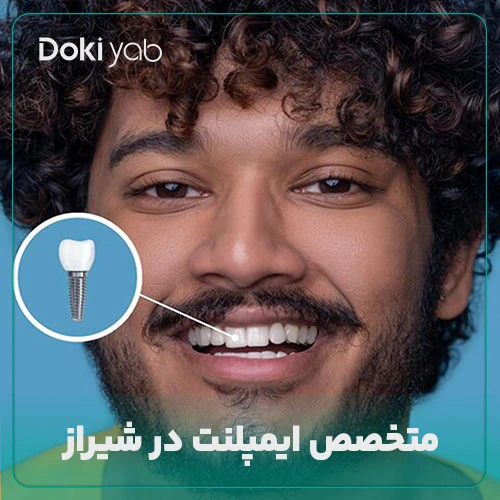 معرفی بهترین متخصص ایمپلنت در شیراز در دکی یاب