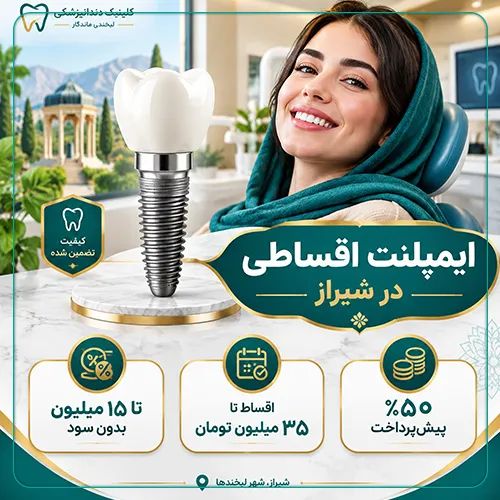 بررسی دقیق شرایط ایمپلنت اقساطی در شیراز