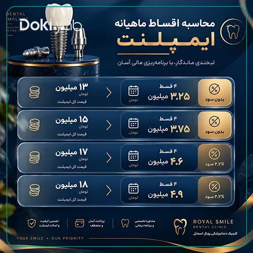 محاسبه اقساط ایمپلنت اقساطی در شیراز