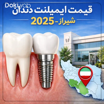 قیمت ایمپلنت دندان در شیراز