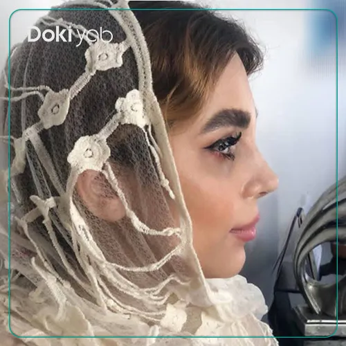 نمونه جراحی بینی با آرش شرفیان متخصص جراحی بینی تهران