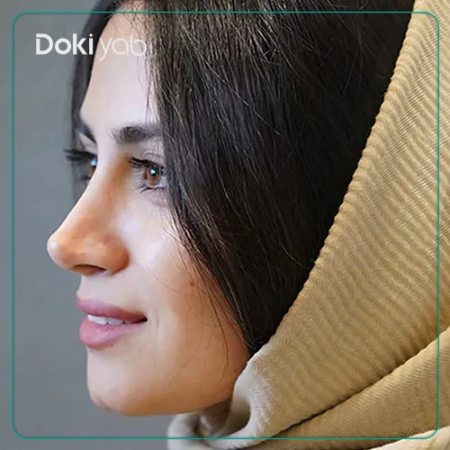 جراحی بینی با دکتر اسدالله مهدوی در تهران