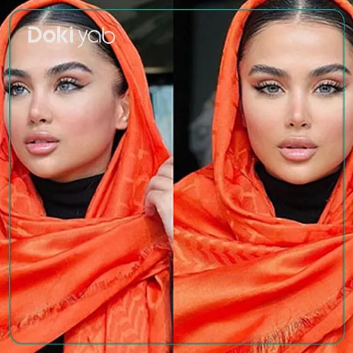 تصویر جراحی بینی توسط دکتر اسدالله مهدوی در تهران