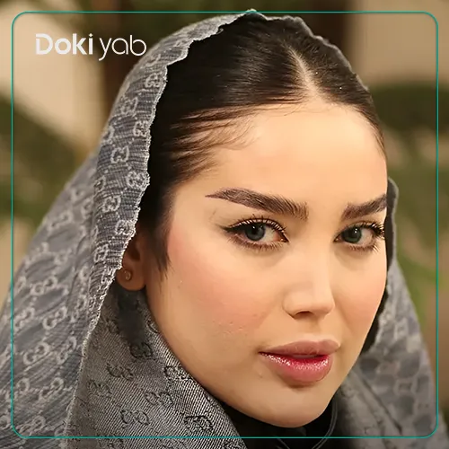 عکس جراحی بینی توسط دکتر شفیعی در تهران