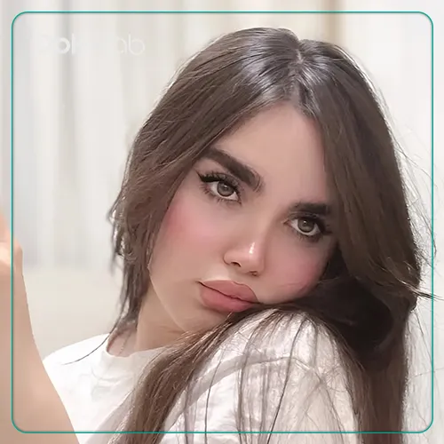 تصویر جراحی بینی توسط دکتر احسان شفیعی در تهران