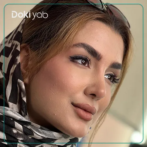 نمونه جراحی بینی با دکتر رویا لطفی یگانه در تهران