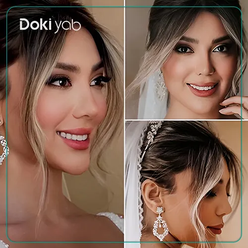 نمونه جراحی بینی با دکتر مهرداد نادریان در تهران
