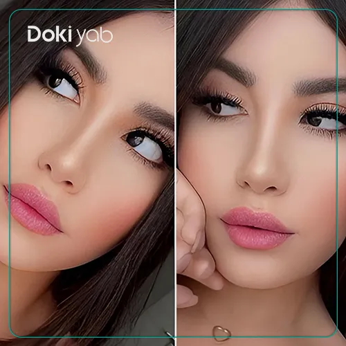 عکس نمونه کار جراحی بینی با دکتر مهرداد نادریان در تهران