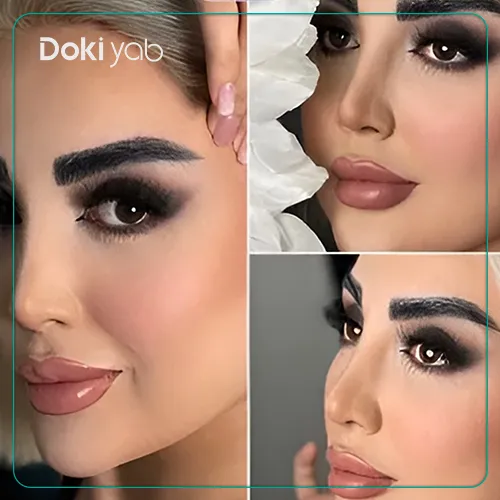 نمونه کار جراحی بینی دکتر مهرداد نادریان در تهران