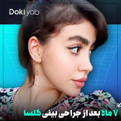نتیجه عمل بینی نیمه فانتزی دکتر مریم بحری