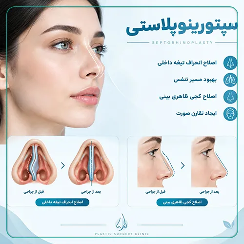بررسی جراحی سپتورینوپلاستی