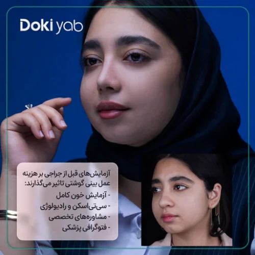 هزینه آزمایش‌های قبل از عمل جزو هزینه عمل بینی پهن و گوشتی است؛ نمونه‌گار جراحی بینی گوشتی در دکی یاب
