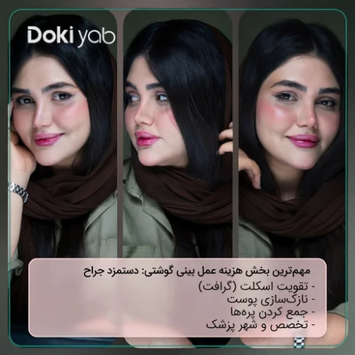 دستمزد پزشک اصلی‌ترین بخش قیمت عمل بینی گوشتی؛ نتیجه جراحی بینی با دکی یاب 
