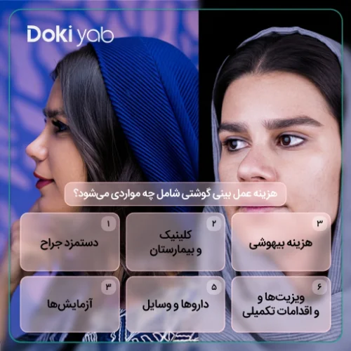 عوامل موثر بر هزینه عمل بینی گوشتی؛ نمونه‌کار عمل بینی در دکی یاب